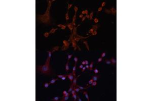 Immunofluorescence analysis of NIH/3T3 cells using GN antibody (ABIN6132000, ABIN6141196, ABIN6141197 and ABIN6214651) at dilution of 1:100. (GNa14 antibody  (AA 40-350))
