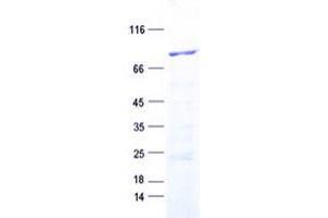 Validation with Western Blot (MCCC1 Protein (His tag))