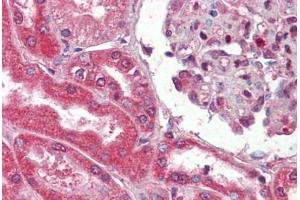 Human Kidney (formalin-fixed, paraffin-embedded) stained with Collagen I antibody ABIN462339 followed by biotinylated goat anti-rabbit IgG secondary antibody ABIN481713, alkaline phosphatase-streptavidin and chromogen. (Collagen Type I antibody)