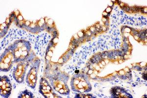 Anti- gamma Catenin Picoband antibody, IHC(P) IHC(P): Rat Intestine Tissue (JUP antibody  (AA 556-745))