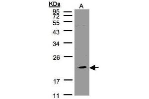 WB Image Sample(30 μg of whole cell lysate) A:293T 12% SDS PAGE antibody diluted at 1:1000 (KLRC4 antibody  (N-Term))