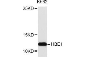 Western blot analysis of extracts of K562 cell line, using HBE1 antibody.