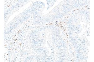 Immunohistochemistry (IHC) image for anti-CD14 (CD14) (AA 20-352) antibody (ABIN7453998)