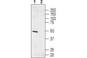 Western blot analysis of human SHSY-5Y neuroblastoma cell lysate: - 1. (KCNJ11 antibody  (C-Term, Intracellular))