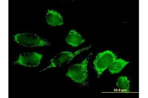 Immunofluorescence of purified MaxPab antibody to DLAT on HeLa cell. (DLAT antibody  (AA 1-647))