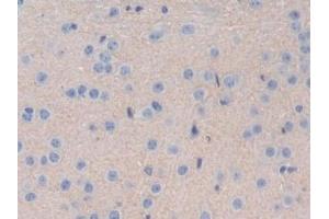 Detection of IL35 in Mouse Cerebrum Tissue using Polyclonal Antibody to Interleukin 35 (IL35)