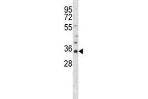 Olig1 antibody western blot analysis in mouse heart tissue lysate. (OLIG1 antibody  (AA 200-228))