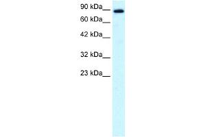 WB Suggested Anti-KIF21A Antibody Titration:  0. (KIF21A antibody  (N-Term))