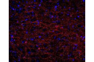 Indirect immunostaining of PFA fixed rat brain section (dilution 1 : 500; red). (Cnpase antibody)
