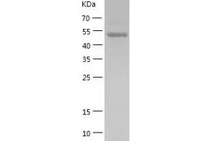 Western Blotting (WB) image for Zinc Finger, MYND-Type Containing 10 (ZMYND10) (AA 1-440) protein (His tag) (ABIN7125814) (ZMYND10 Protein (AA 1-440) (His tag))
