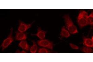 ABIN6266839 staining NIH-3T3 by IF/ICC. (alpha Tubulin antibody)