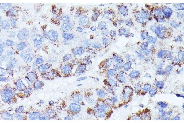 CCDC6 antibody