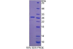 SDS-PAGE analysis of Rat SSA1 Protein. (TRIM21 Protein)