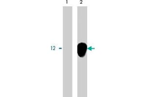 Immunoprecipitation using DAP12 polyclonal antibody on MHC class I (1) and NKp44 (2) positive cells. (TYROBP antibody)