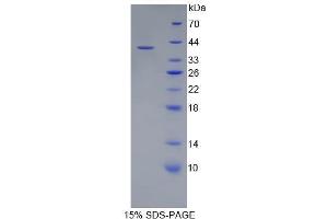 SDS-PAGE (SDS) image for Complement Component 5a (C5a) (AA 1-77) protein (His tag,GST tag) (ABIN2122687) (C5A Protein (AA 1-77) (His tag,GST tag))
