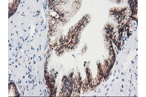 Image no. 2 for anti-Vascular Cell Adhesion Molecule 1 (VCAM1) antibody (ABIN1497155) (VCAM1 antibody)