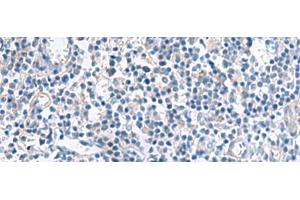Immunohistochemistry of paraffin-embedded Human tonsil tissue using MYL1 Polyclonal Antibody at dilution of 1:50(x200)