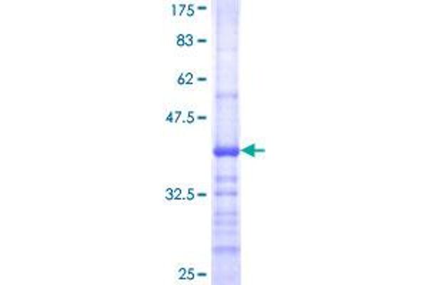 FCGR1A Protein (AA 16-115) (GST tag)