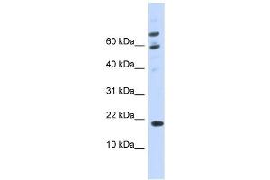 C21ORF87 antibody used at 1 ug/ml to detect target protein. (BRWD1-AS2 antibody)