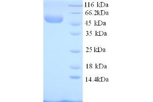 SDS-PAGE (SDS) image for Selectin E (SELE) (AA 24-495), (Extracellular) protein (His tag) (ABIN5713818)