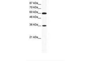 Image no. 1 for anti-Forkhead Box F1 (FOXF1) (AA 26-75) antibody (ABIN202325) (FOXF1 antibody  (AA 26-75))