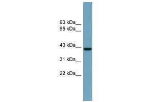 NUDCD3 antibody used at 1 ug/ml to detect target protein. (NUDCD3 antibody  (Middle Region))