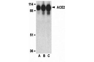 Western Blotting (WB) image for anti-Angiotensin I Converting Enzyme 2 (ACE2) (Middle Region 1) antibody (ABIN1031184) (ACE2 antibody  (Middle Region 1))