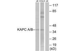 Western blot analysis of extracts from Jurkat cells and COLO cells, using KAPC A/B antibody. (PRKACA antibody  (N-Term))