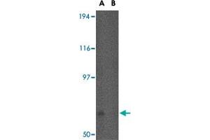 Western blot analysis of FNBP1L in human brain tissue lysate in (A) the absence and (B) the presence of blocking peptide with FNBP1L polyclonal antibody  at 0.