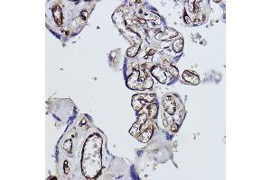 Immunohistochemistry of paraffin-embedded human placenta using Tryptophanyl-tRNA synthetase 1 Rabbit mAb (ABIN1678761, ABIN3018963, ABIN3018964 and ABIN7101695) at dilution of 1:100 (40x lens). (WARS antibody)