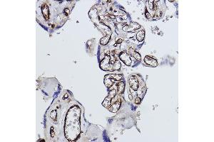 Immunohistochemistry of paraffin-embedded human placenta using Tryptophanyl-tRNA synthetase 1 Rabbit mAb (ABIN1678761, ABIN3018963, ABIN3018964 and ABIN7101695) at dilution of 1:100 (40x lens). (WARS antibody)