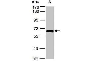 WB Image Sample(30 ug whole cell lysate) A:HeLa S3, 7. (ZNF169 antibody)