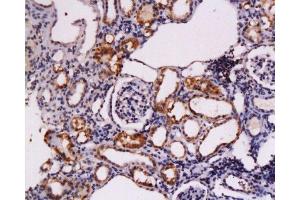 Formalin-fixed and paraffin embedded rat kidney tissue labeled Anti-CD117/c-kit/SCFR Polyclonal Antibody, Unconjugated  at 1:200, followed by conjugation to the secondary antibody and DAB staining (KIT antibody  (AA 901-976))
