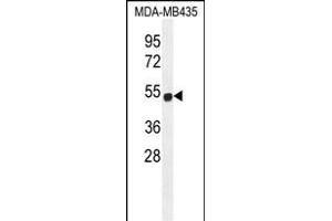 ZNF286B Antibody (N-term) (ABIN655669 and ABIN2845137) western blot analysis in MDA-M cell line lysates (35 μg/lane).