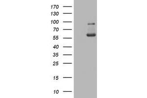 Western Blotting (WB) image for anti-PKM1 antibody (ABIN2729046) (PKM1 antibody)