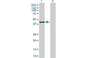 Western Blot analysis of C13orf31 expression in transfected 293T cell line by C13orf31 MaxPab polyclonal antibody. (LACC1 antibody  (AA 1-430))