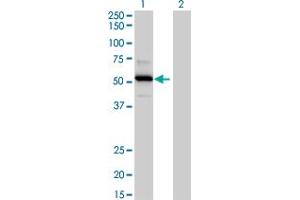 Western Blot analysis of TRAF4 expression in transfected 293T cell line by TRAF4 MaxPab polyclonal antibody. (TRAF4 antibody  (AA 1-470))