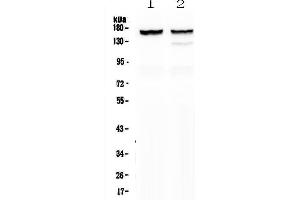 Western blot analysis of MYBPC3 using anti-MYBPC3 antibody . (MYBPC3 antibody  (AA 1070-1123))