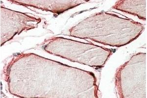 Image no. 1 for anti-Caveolin 3 (CAV3) (N-Term) antibody (ABIN375161) (Caveolin 3 antibody  (N-Term))