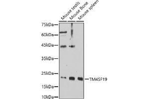 Western blot analysis of extracts of various cell lines, using TM4SF19 antibody (ABIN7270936) at 1:1000 dilution. (TM4SF19 antibody  (AA 50-150))