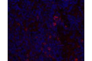 Immunofluorescence analysis of paraffin-embedded mouse inflammatory spleen using IL2 Polyclonal Antibody at dilution of 1:300. (IL-2 antibody)