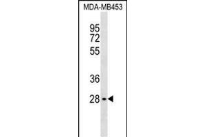 GBL Antibody (C-term) (ABIN1537039 and ABIN2838246) western blot analysis in MDA-M cell line lysates (35 μg/lane). (GBL antibody  (C-Term))