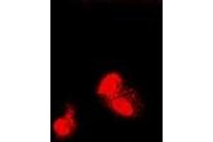 Immunofluorescent analysis of SIAH1 staining in U2OS cells. (SIAH1 antibody)