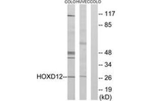 Western blot analysis of extracts from COLO205/HucEc cells, treated with serum 20% 15', using HOXD12 Antibody.