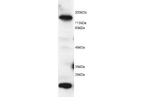 ABIN184584 (2 µg/mL) staining of Hela lysate (RIPA buffer, 1. (MTR antibody  (C-Term))
