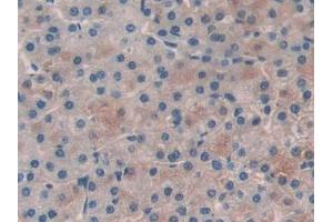 Used in DAB staining on fromalin fixed paraffin- embedded prostate gland tissue (PLAA antibody  (AA 534-792))