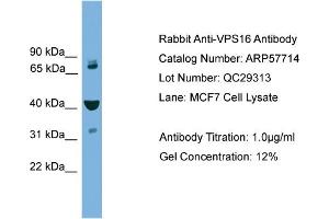 WB Suggested Anti-VPS16  Antibody Titration: 0. (VPS16 antibody  (Middle Region))