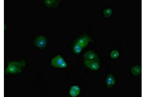 Immunofluorescent analysis of MCF-7 cells using ABIN7145812 at dilution of 1:100 and Alexa Fluor 488-congugated AffiniPure Goat Anti-Rabbit IgG(H+L) (BRD4 antibody  (AA 150-200))