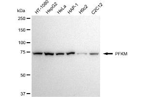 anti-phosphofructokinase, Muscle (PFKM) antibody