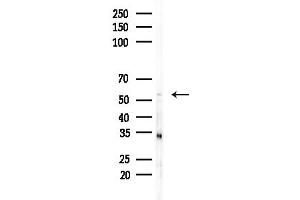 anti-Fc Fragment of IgG, High Affinity Ia, Receptor (CD64) (FCGR1A) (Internal Region) antibody